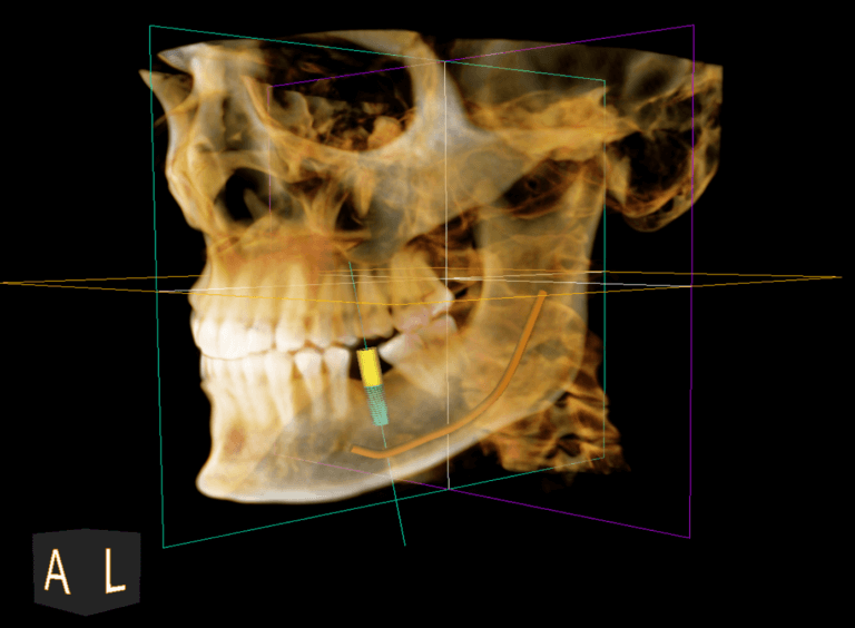cbct-scan-768x564