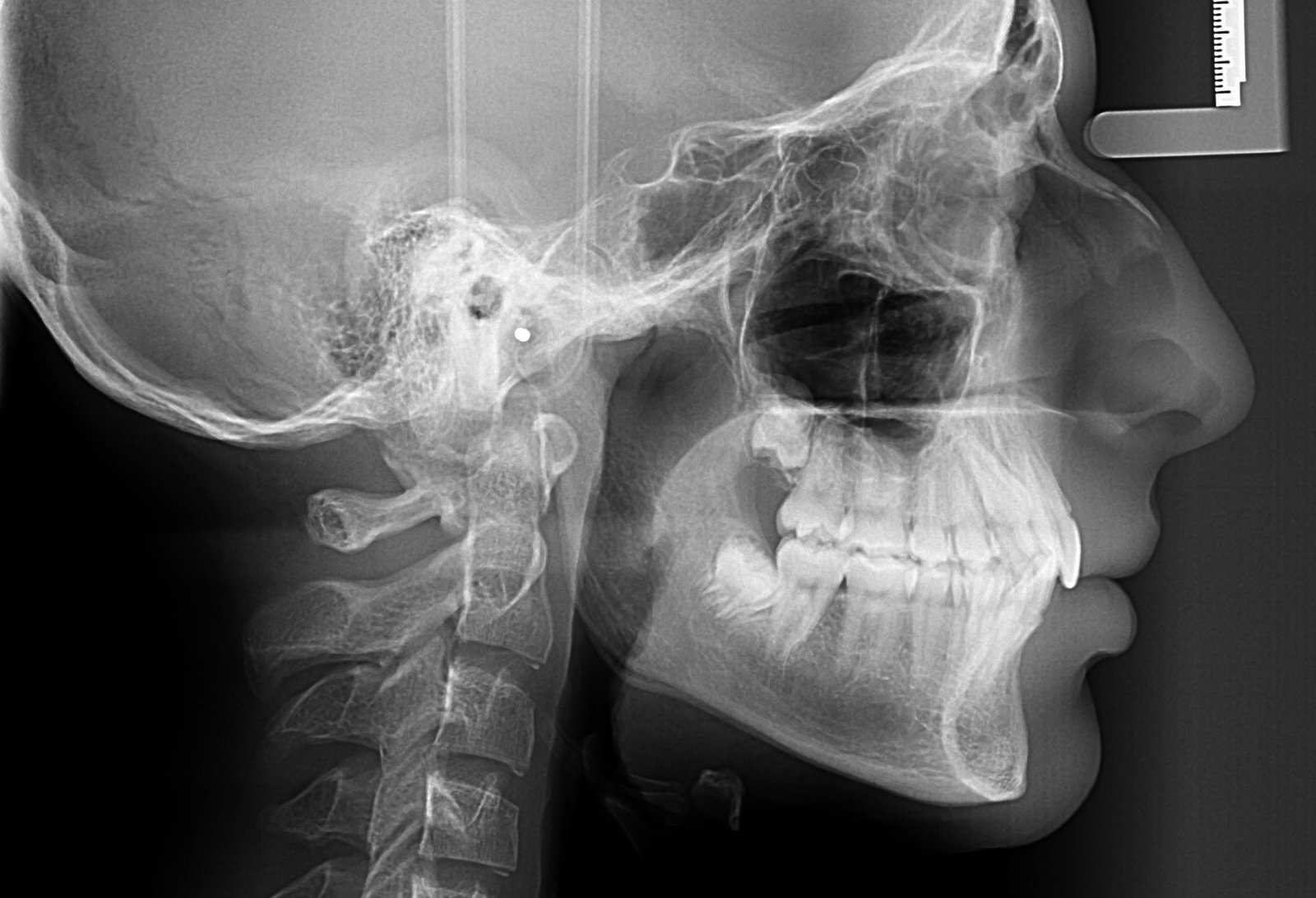 3.3-poza-CEPH-1926x1315