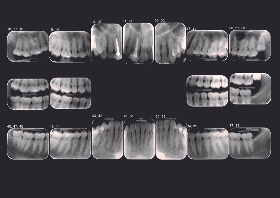 Radiografia-de-status-bimaxilar